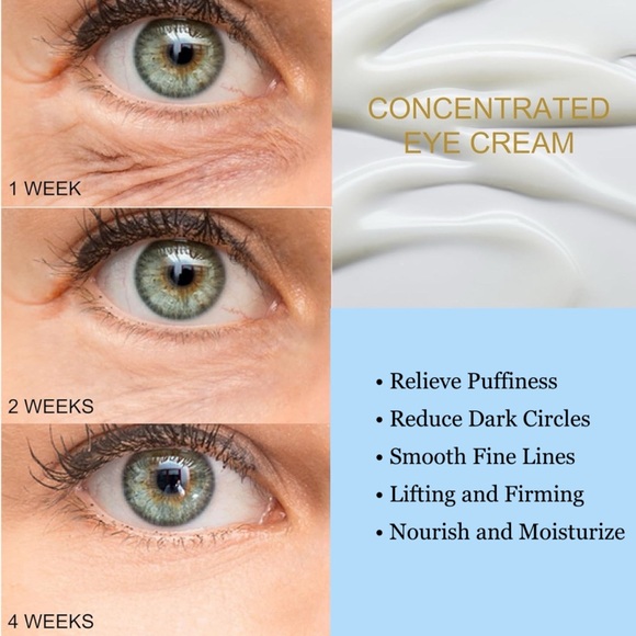 Retinol Eye Cream With Electric Massage Anti-Wrinkle for Puffiness & Bags - Picture 4 of 11